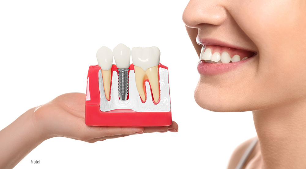 an educational model of a dental implant with a happy smiling patient