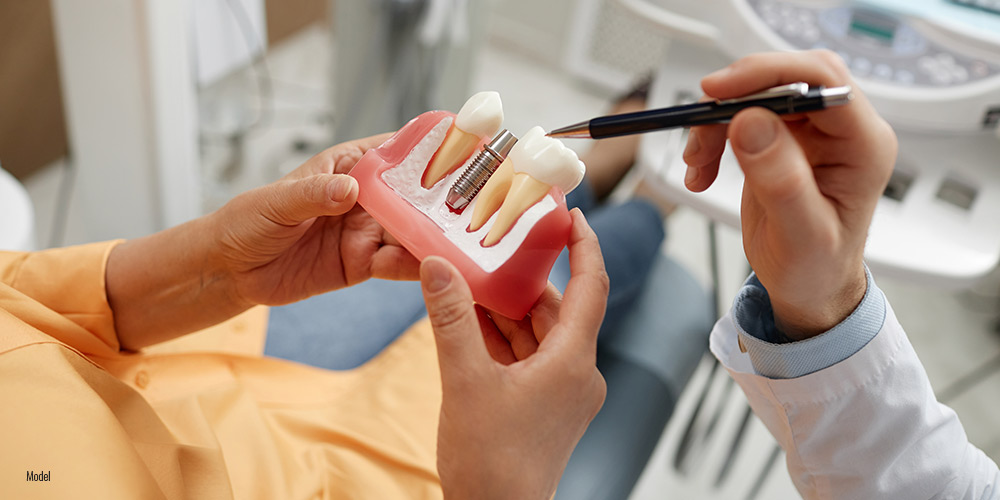 Dentist with dental implant model 